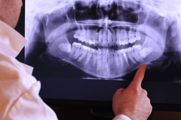 Best Emergency Root Canal Treatment in Lordstown, OH