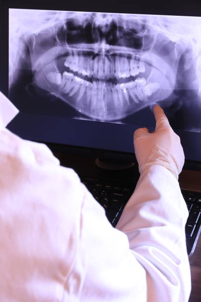 Best Emergency Treatment for Dental Infections or Abscesses in Lordstown, OH