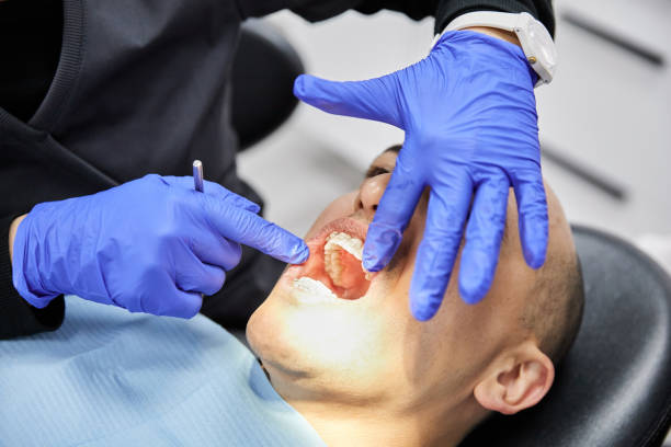 Best Emergency Treatment for Dental Infections or Abscesses in Lordstown, OH