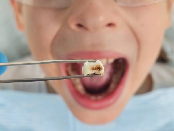 Best Emergency Gum Treatment in Lordstown, OH